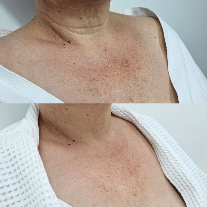 Работа с полимолочной кислотой