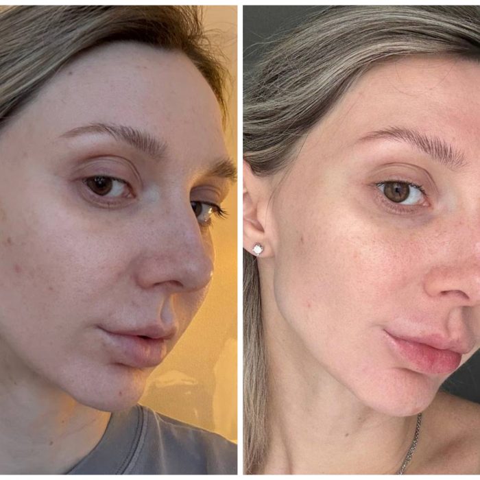 Работа с качеством  кожи (онлайн)