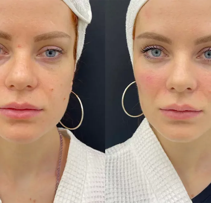 КОМПЛЕКСНОЕ ОМОЛОЖЕНИЕ С АКЦЕНТОМНА СРЕДНЮЮ ТРЕТЬ ЛИЦА