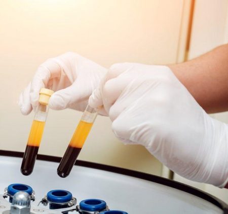 Platelet-Rich plasma preparation. Tube with blood in hands. Centrifuge. Background