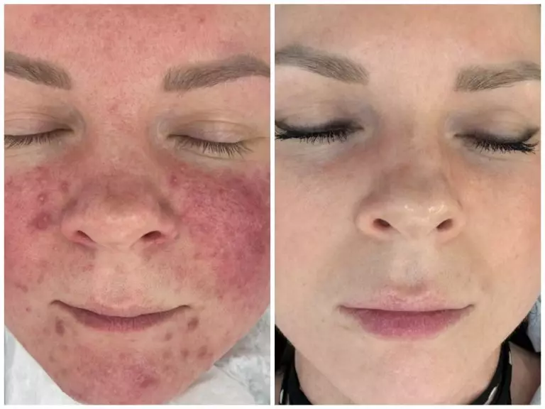 Collage_20250527180848