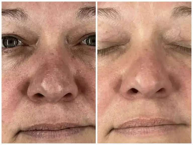 Collage_20250527181350