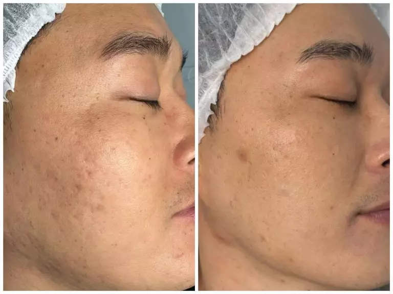 Collage_20250527181732