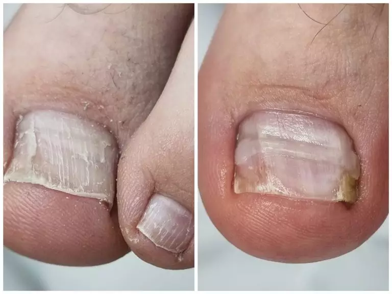 Collage_20250528173722